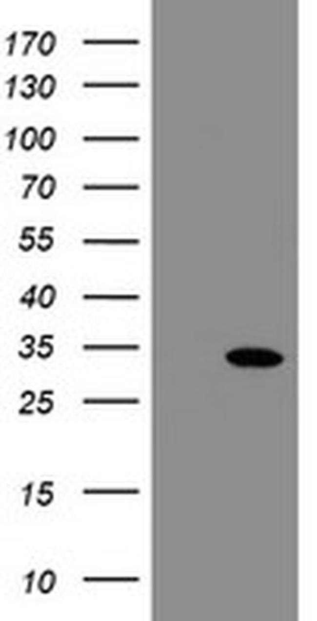 SLA2 Antibody in Western Blot (WB)