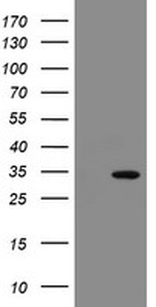 SLA2 Antibody in Western Blot (WB)