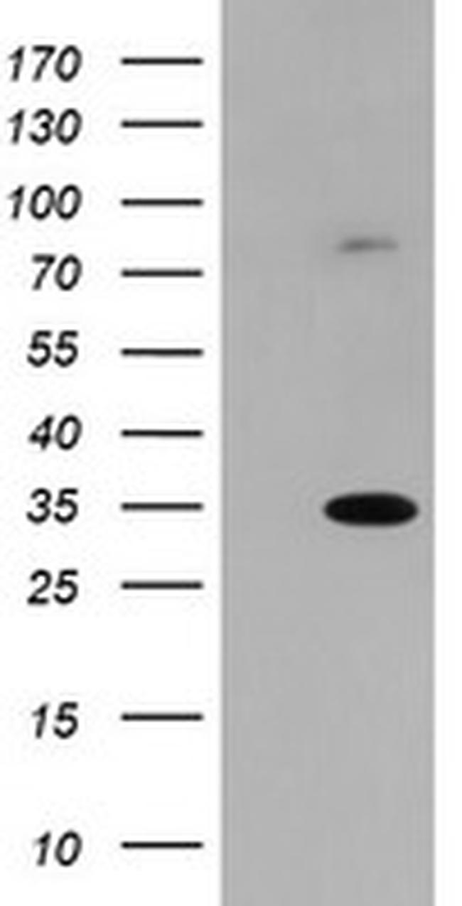 SLA2 Antibody in Western Blot (WB)