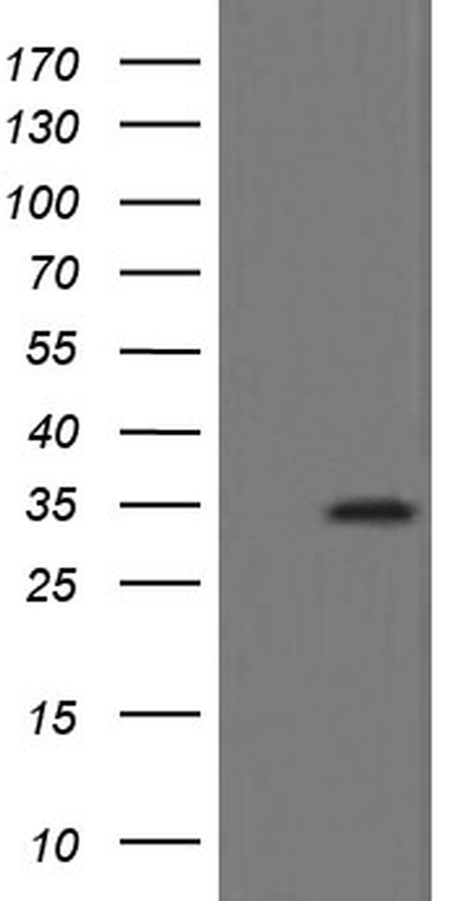 SLA2 Antibody in Western Blot (WB)