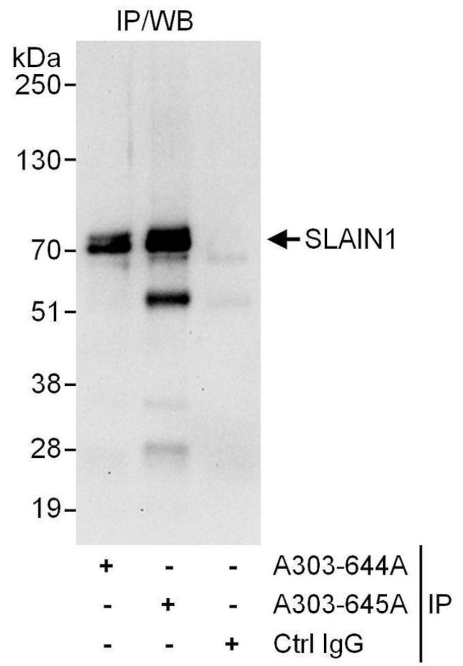 SLAIN1 Antibody in Immunoprecipitation (IP)