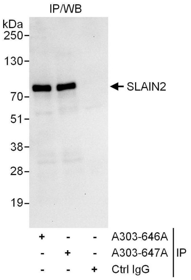 SLAIN2 Antibody in Immunoprecipitation (IP)