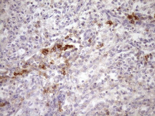 SLAMF7 Antibody in Immunohistochemistry (Paraffin) (IHC (P))