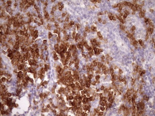 SLAMF7 Antibody in Immunohistochemistry (Paraffin) (IHC (P))