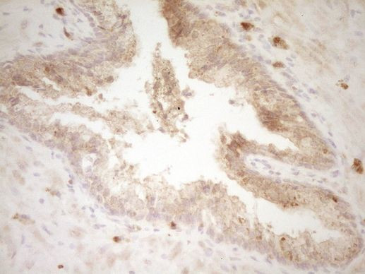 SLAMF7 Antibody in Immunohistochemistry (Paraffin) (IHC (P))