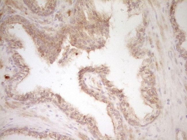 SLAMF7 Antibody in Immunohistochemistry (Paraffin) (IHC (P))