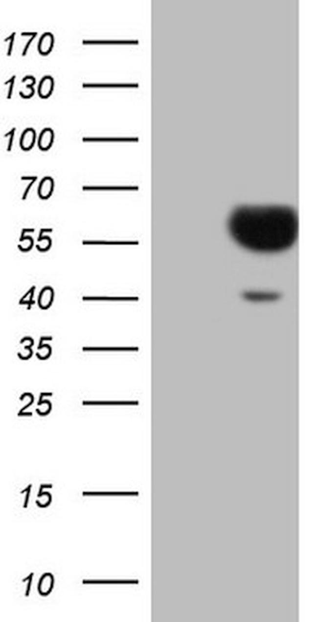 SLAMF7 Antibody in Western Blot (WB)