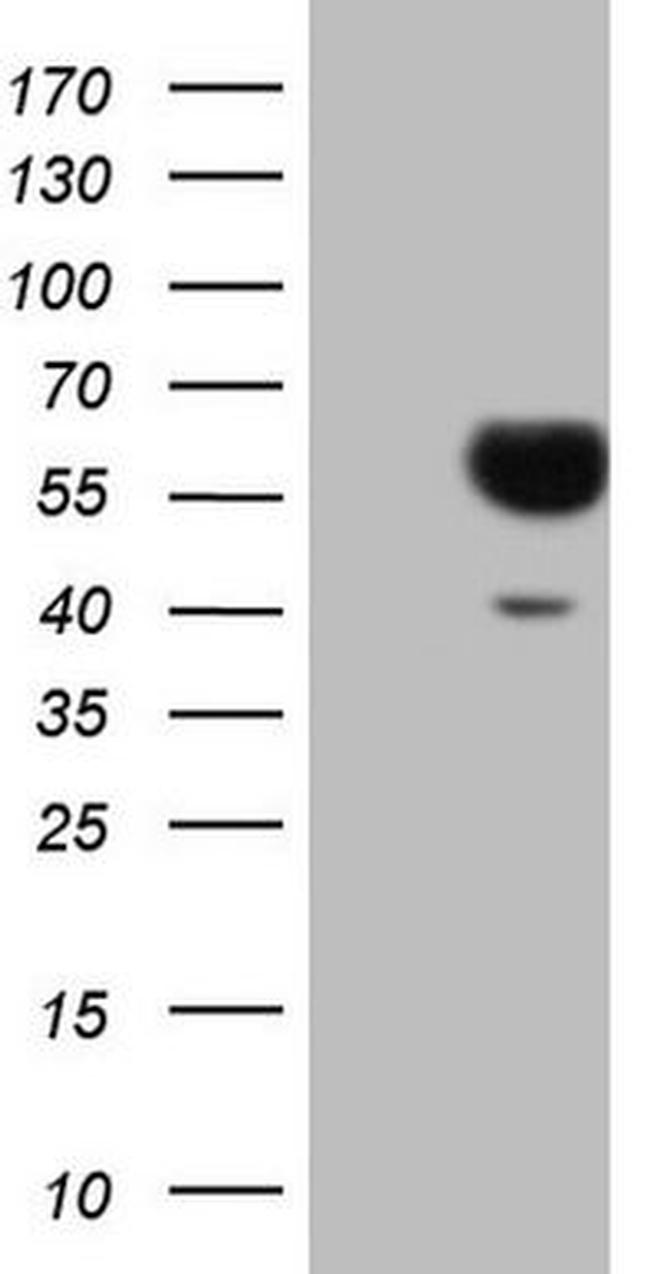 SLAMF7 Antibody in Western Blot (WB)