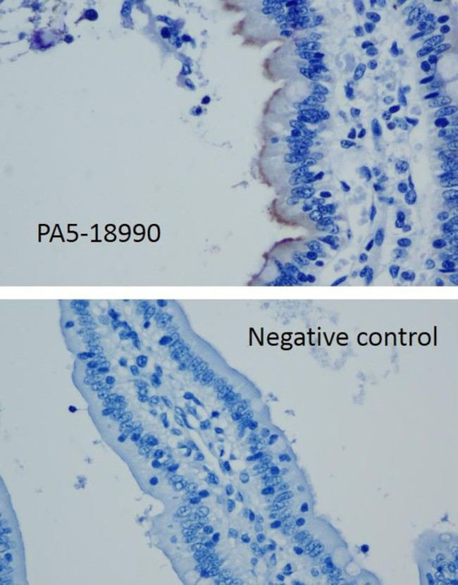 SLC10A2 Antibody in Immunohistochemistry (IHC)