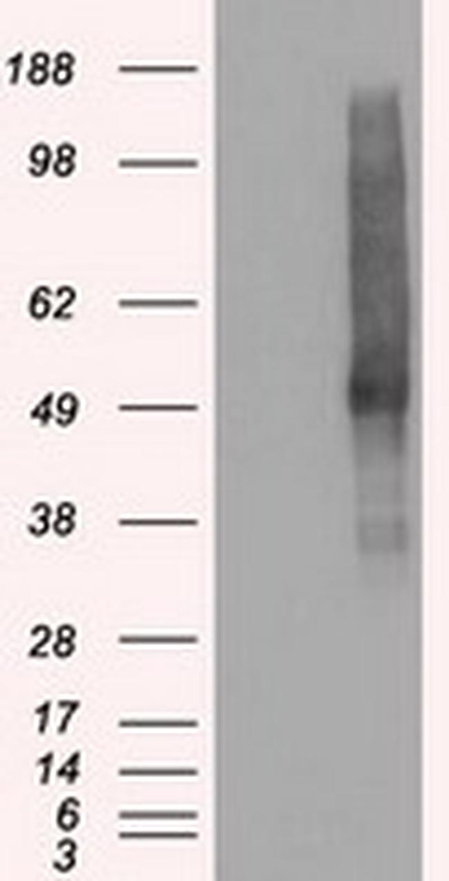 SLC18A2 Antibody in Western Blot (WB)