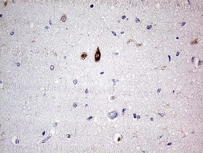 SLC22A17 Antibody in Immunohistochemistry (Paraffin) (IHC (P))