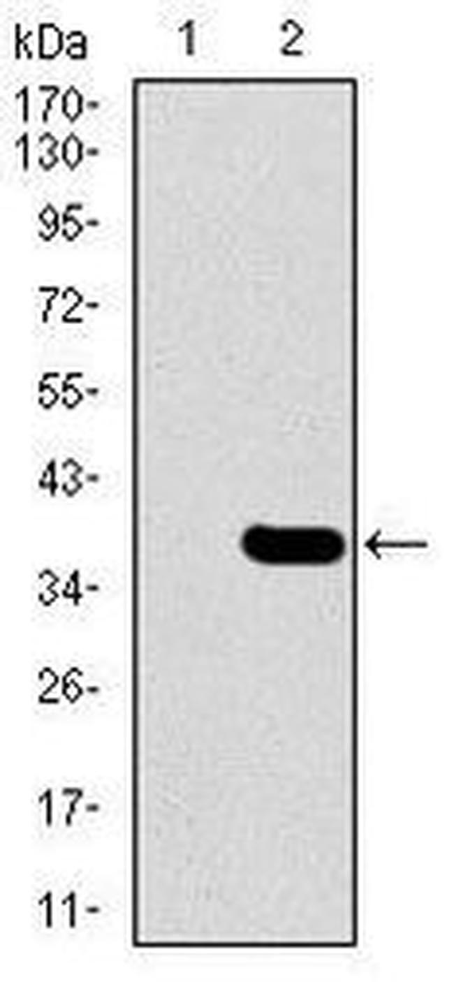 SLC27A5 Antibody in Western Blot (WB)