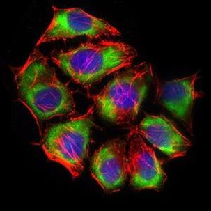 GLUT4 Antibody in Immunocytochemistry (ICC/IF)