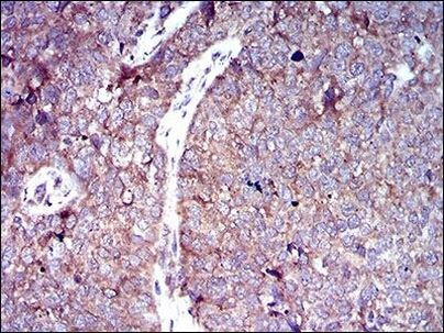 GLUT4 Antibody in Immunohistochemistry (Paraffin) (IHC (P))