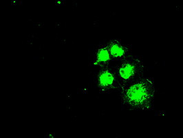 SLC2A5 Antibody in Immunocytochemistry (ICC/IF)