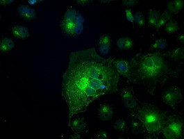 SLC2A5 Antibody in Immunocytochemistry (ICC/IF)