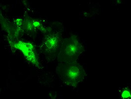 SLC2A5 Antibody in Immunocytochemistry (ICC/IF)