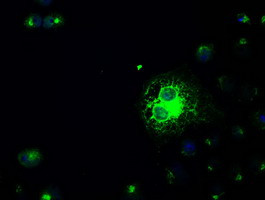 SLC2A5 Antibody in Immunocytochemistry (ICC/IF)