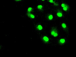 SLC2A5 Antibody in Immunocytochemistry (ICC/IF)