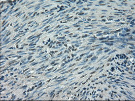 SLC2A5 Antibody in Immunohistochemistry (Paraffin) (IHC (P))