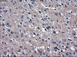 SLC2A5 Antibody in Immunohistochemistry (Paraffin) (IHC (P))