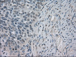 SLC2A5 Antibody in Immunohistochemistry (Paraffin) (IHC (P))