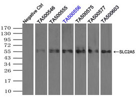 SLC2A5 Antibody in Immunoprecipitation (IP)