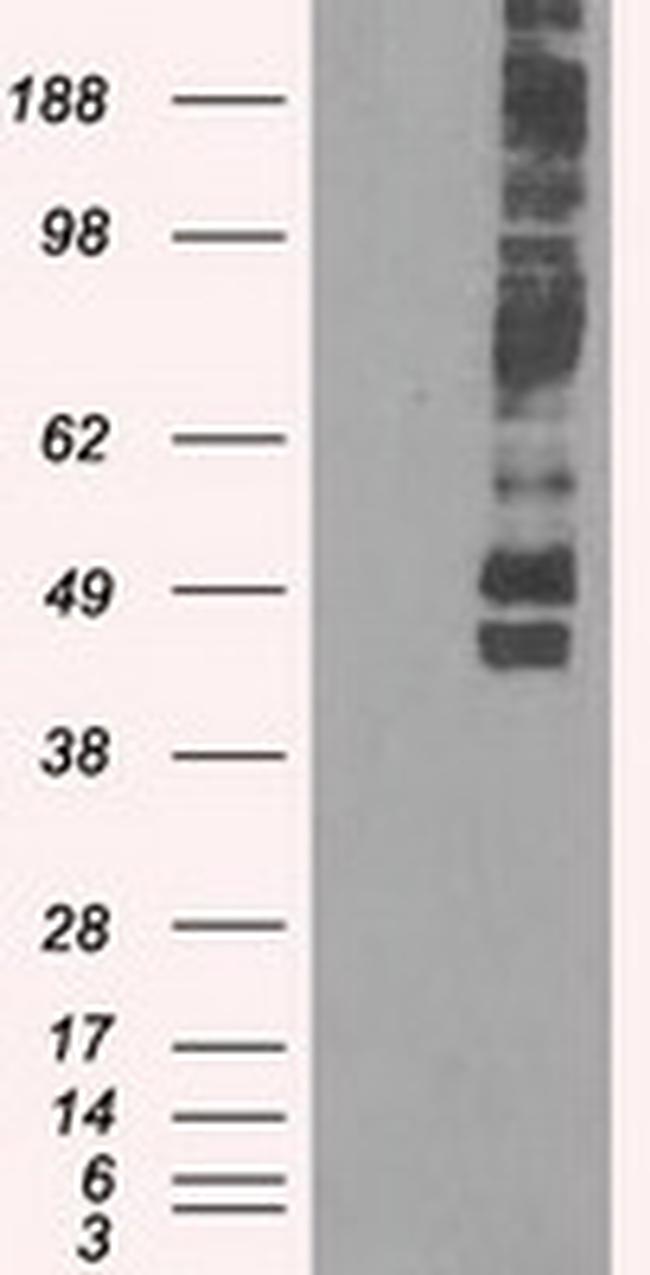 SLC2A5 Antibody in Western Blot (WB)