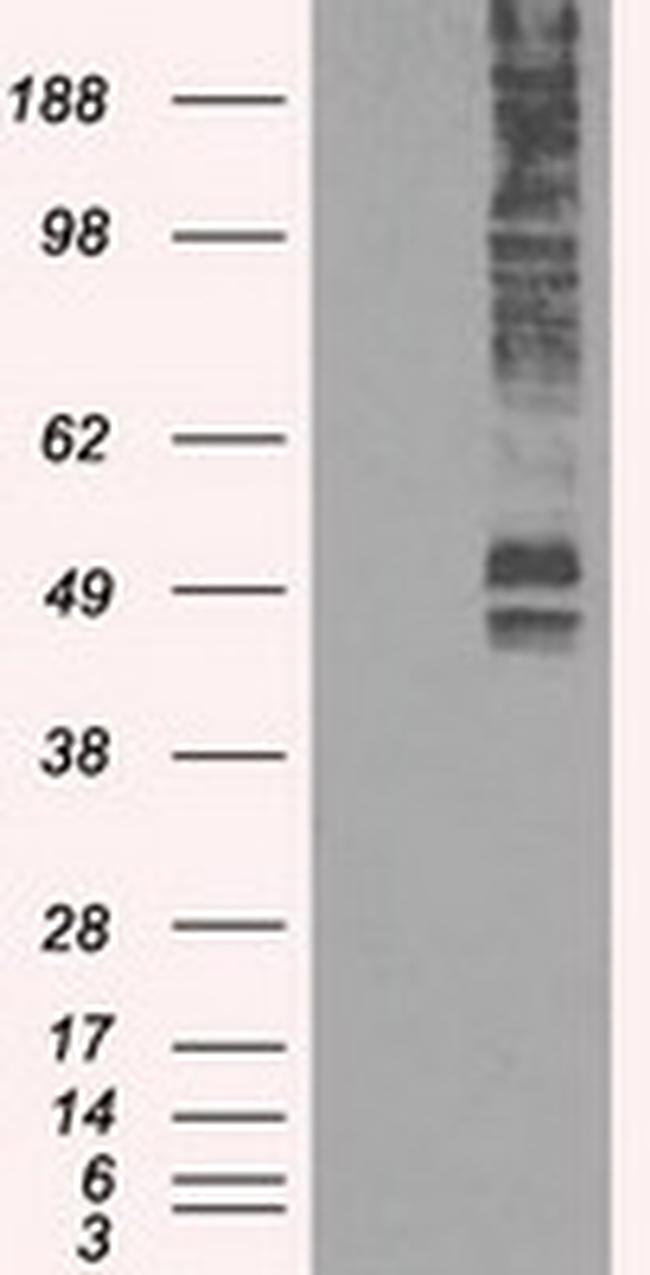 SLC2A5 Antibody in Western Blot (WB)