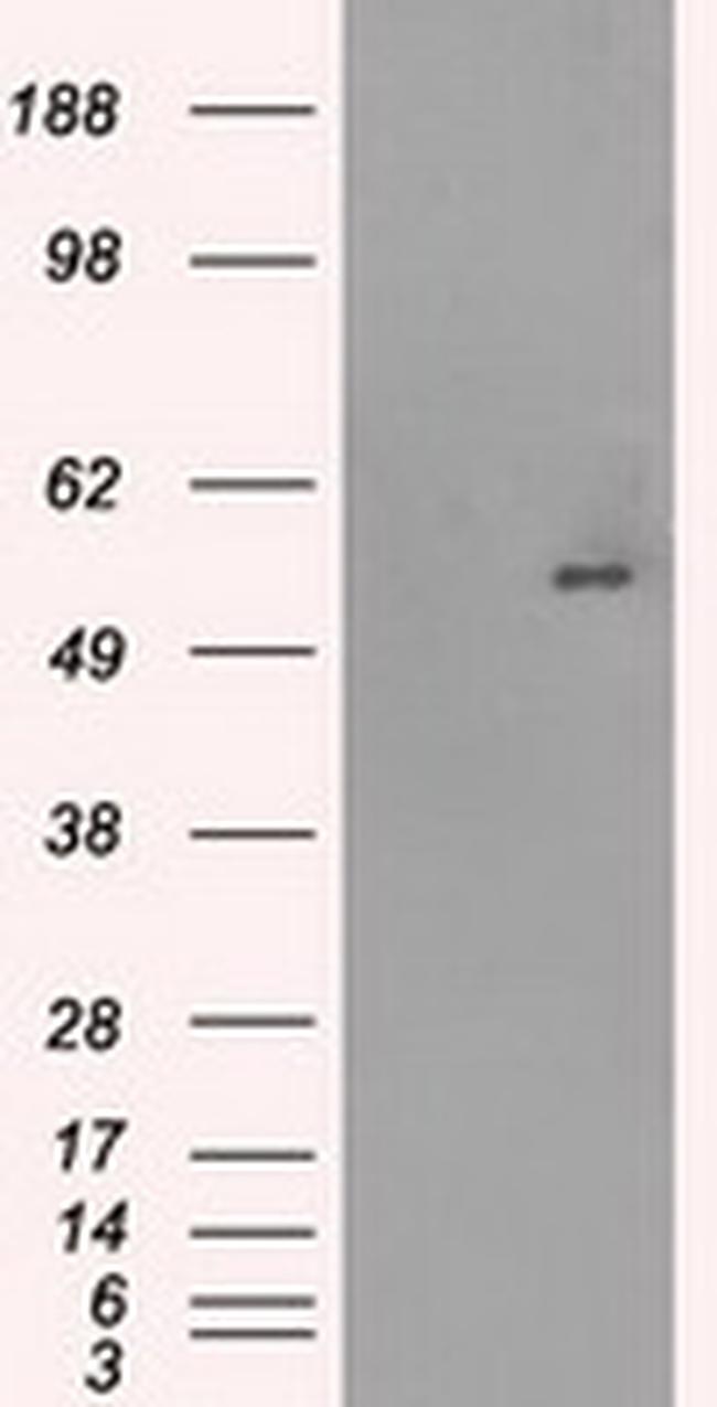 SLC2A5 Antibody in Western Blot (WB)