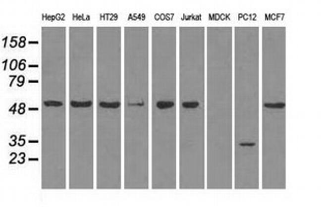 SLC2A5 Antibody in Western Blot (WB)