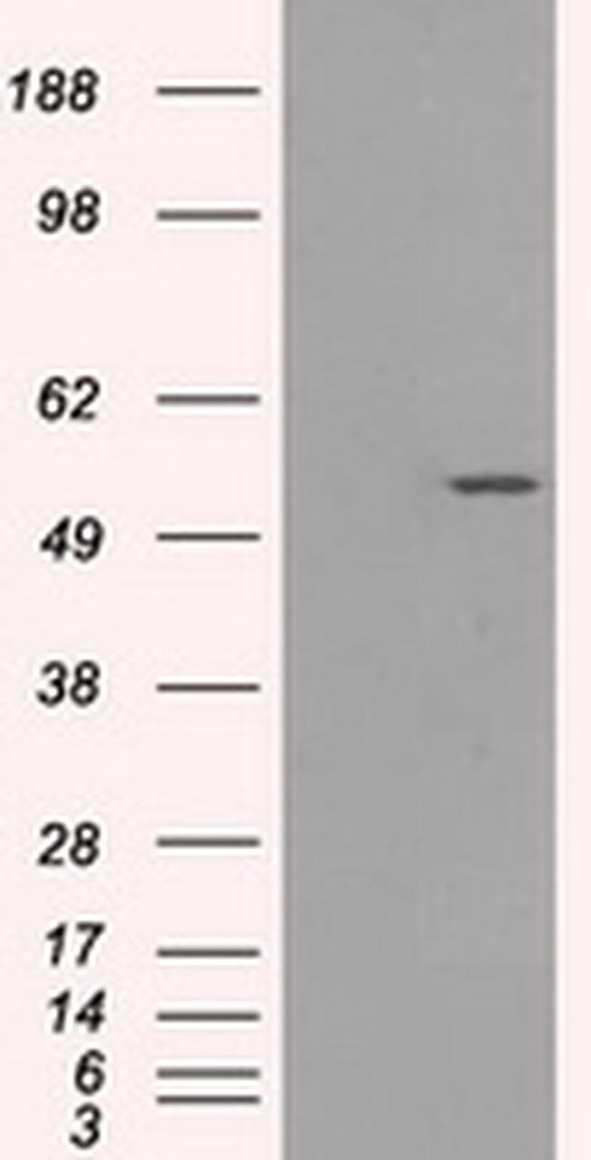 SLC2A5 Antibody in Western Blot (WB)