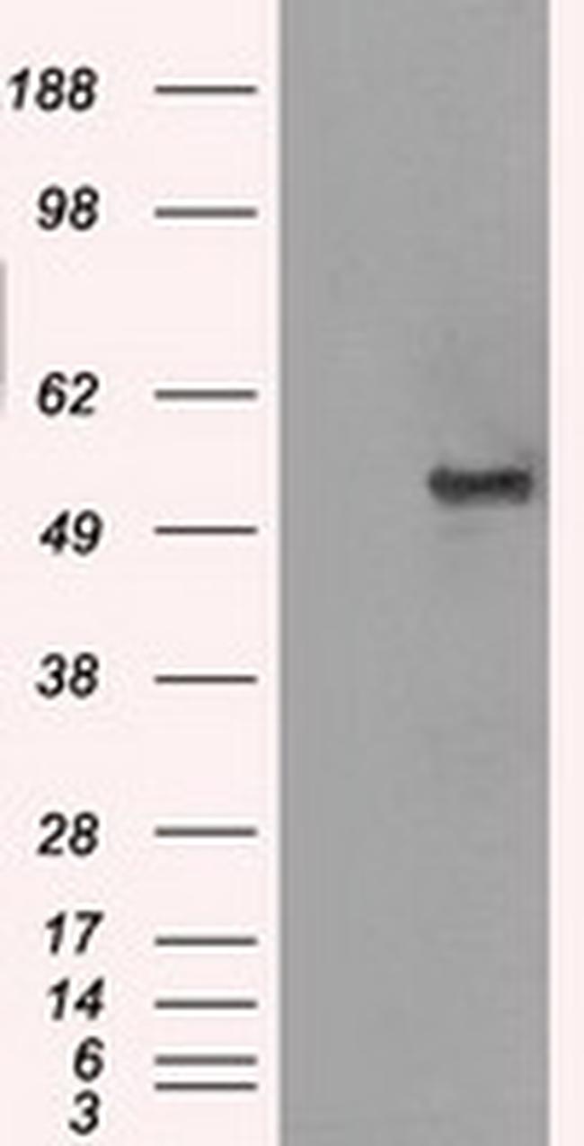 SLC2A5 Antibody in Western Blot (WB)