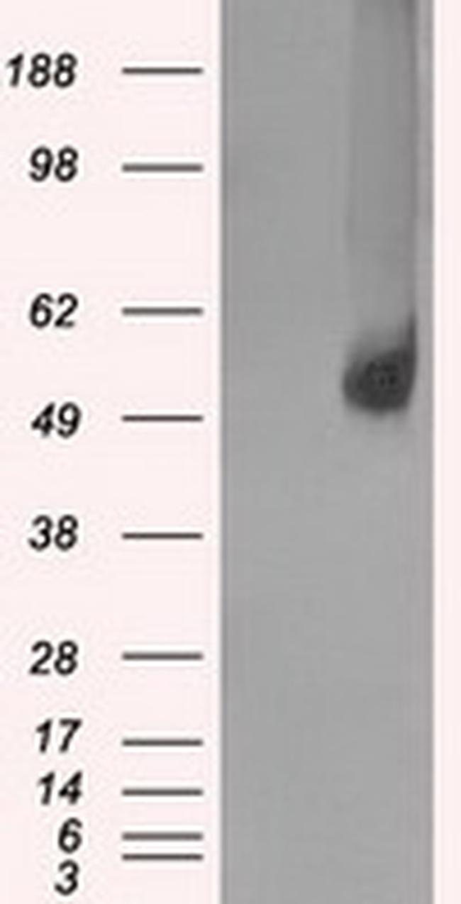 SLC2A5 Antibody in Western Blot (WB)