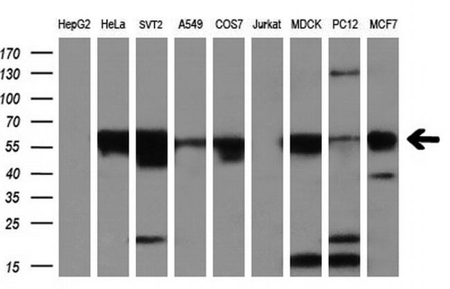 SLC2A5 Antibody in Western Blot (WB)