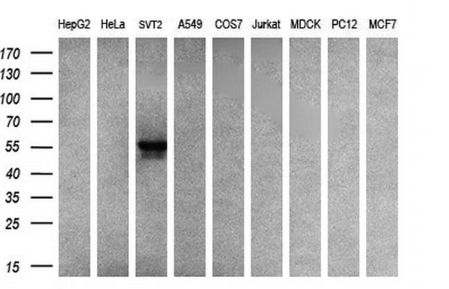 SLC2A5 Antibody in Western Blot (WB)