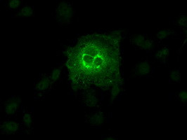 SLC2A6 Antibody in Immunocytochemistry (ICC/IF)