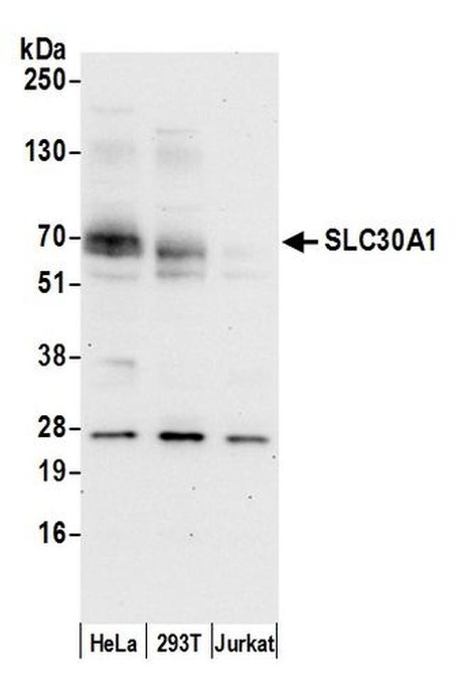 SLC30A1/ZNT1 Antibody in Western Blot (WB)