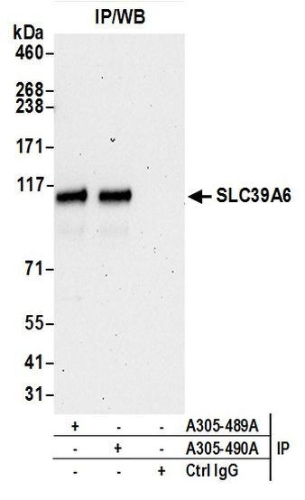 SLC39A6 Antibody in Immunoprecipitation (IP)