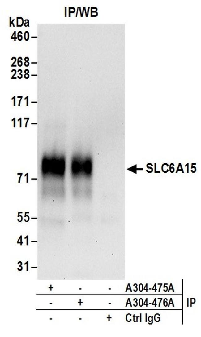 SLC6A15 Antibody in Western Blot (WB)