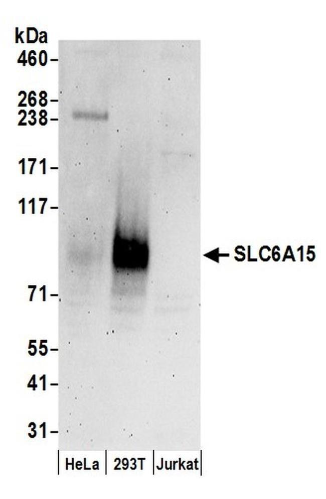 SLC6A15 Antibody in Western Blot (WB)