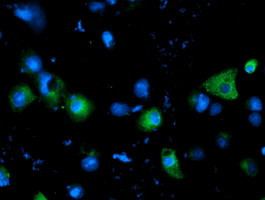 SLC7A8 Antibody in Immunocytochemistry (ICC/IF)