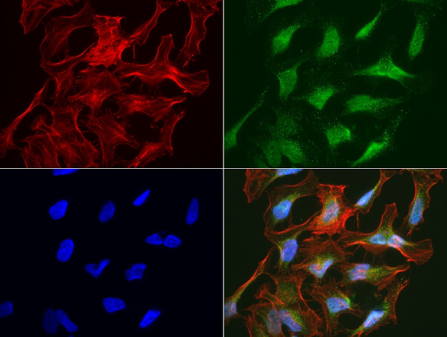 SLC7A8 Antibody in Immunocytochemistry (ICC/IF)