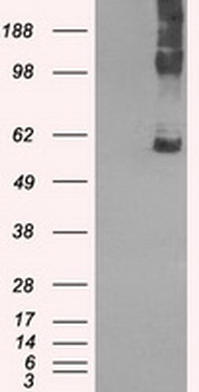 SLC7A8 Antibody in Western Blot (WB)