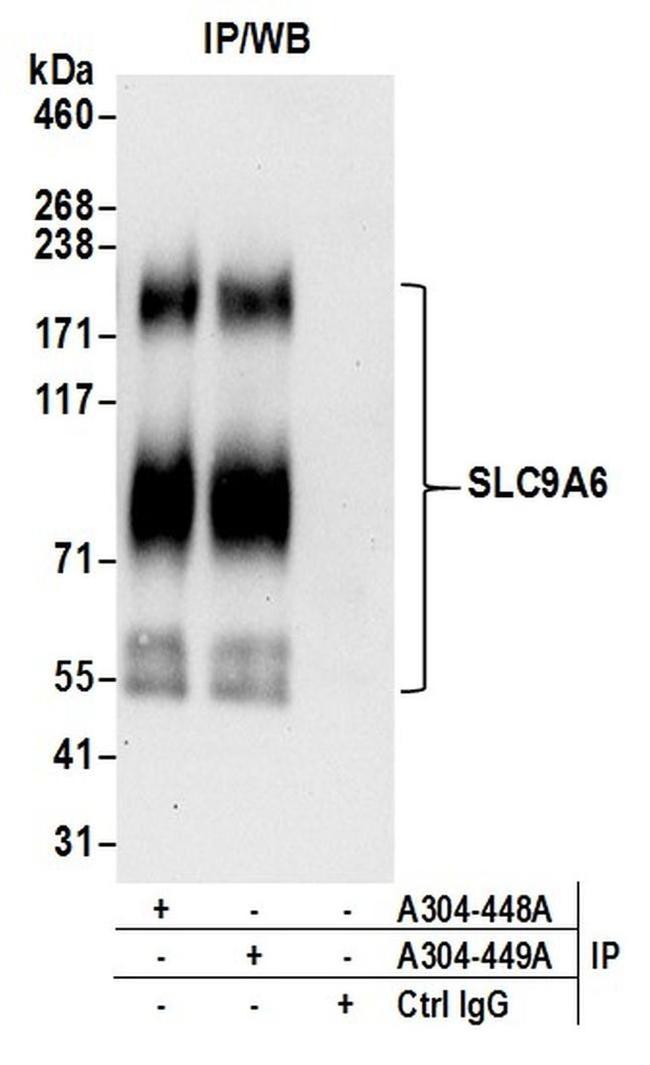 SLC9A6 Antibody in Western Blot (WB)