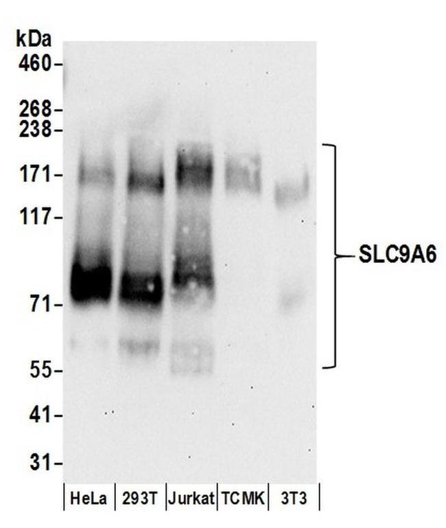 SLC9A6 Antibody in Western Blot (WB)