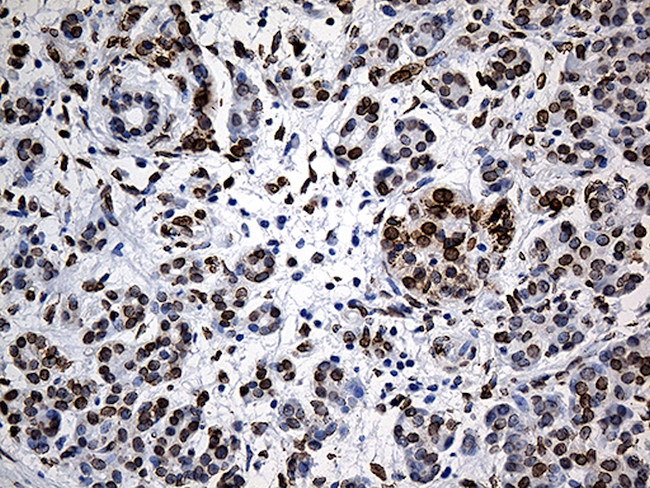 SLU7 Antibody in Immunohistochemistry (Paraffin) (IHC (P))