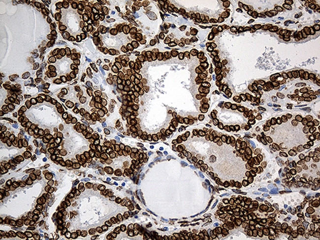 SLU7 Antibody in Immunohistochemistry (Paraffin) (IHC (P))