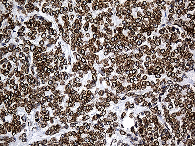 SLU7 Antibody in Immunohistochemistry (Paraffin) (IHC (P))