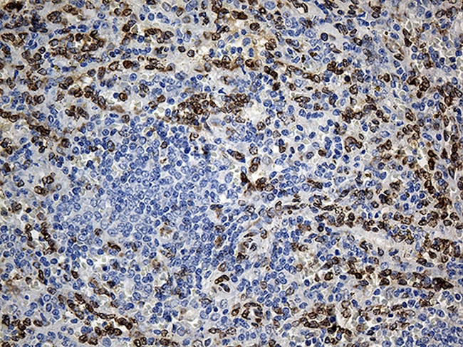 SLU7 Antibody in Immunohistochemistry (Paraffin) (IHC (P))